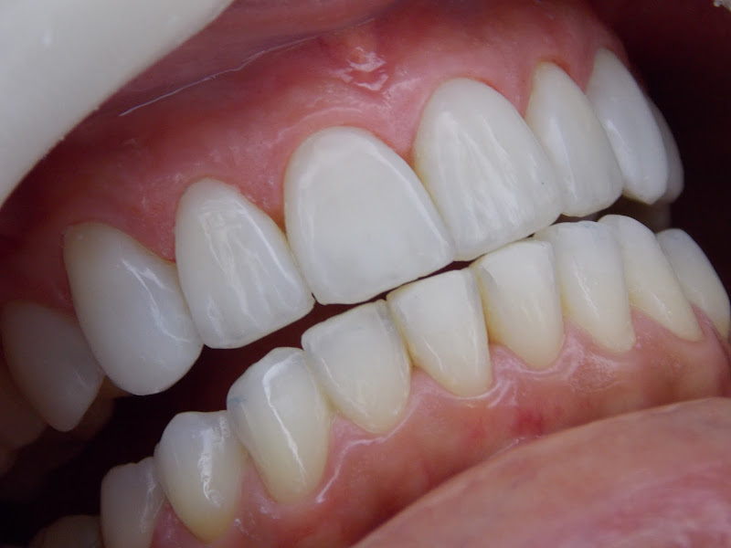 Foto 3 de SILVEIRA ODONTOLOGIA - Dr. Luiz Gustavo da Silveira