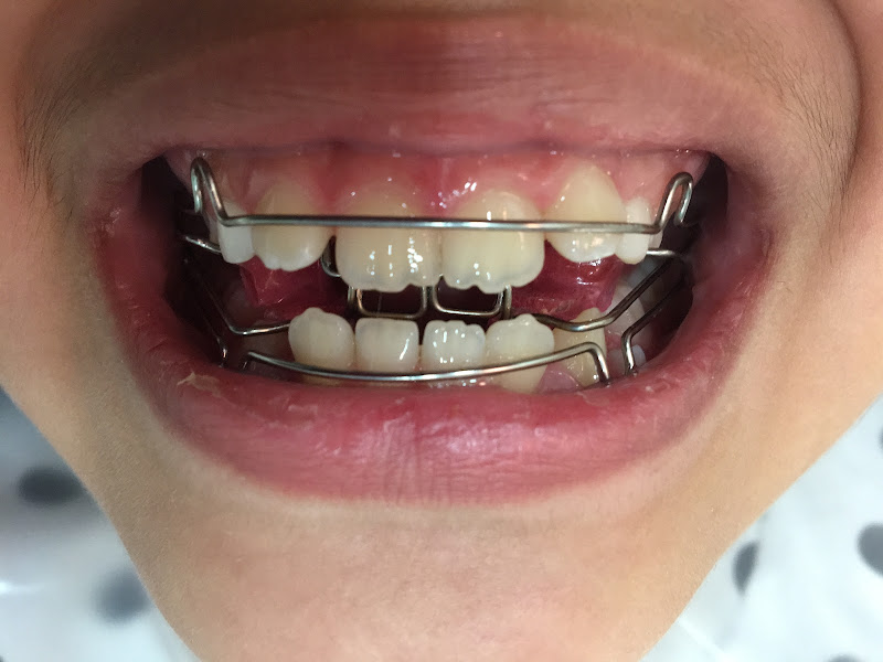 Foto 3 de SIMEL ODONTO MÉDICO