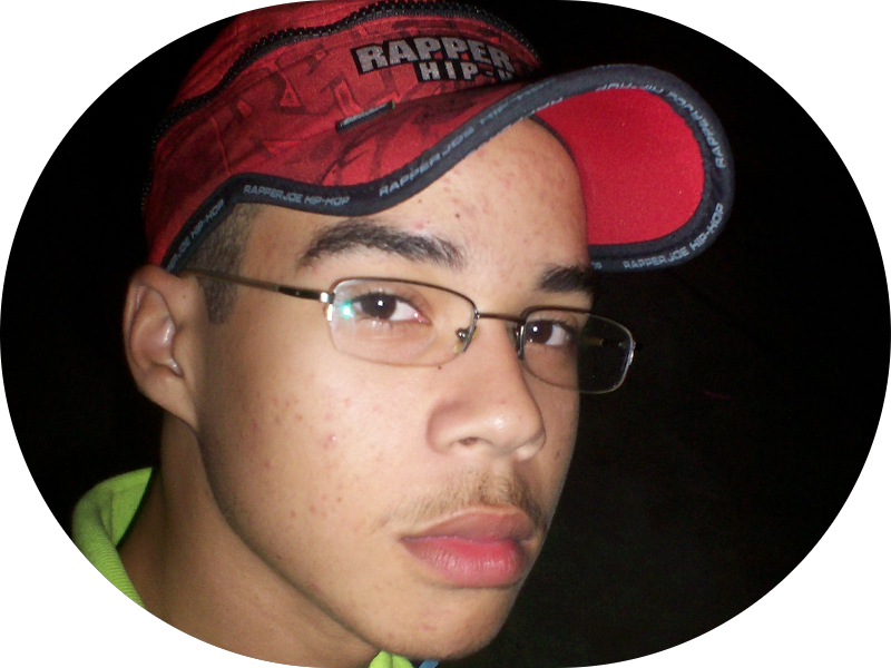 Foto 7 de Simioni Odontologia - Implante e Lente de Contato Dental