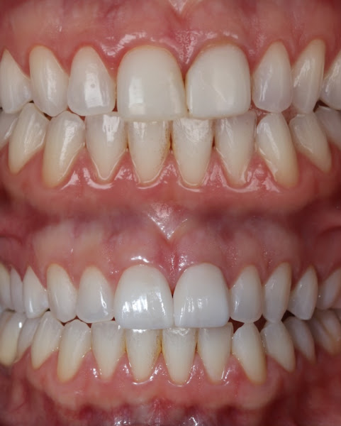 Foto 3 de Simone Baldisserotto - Odontologia Estética e Reabilitação Oral