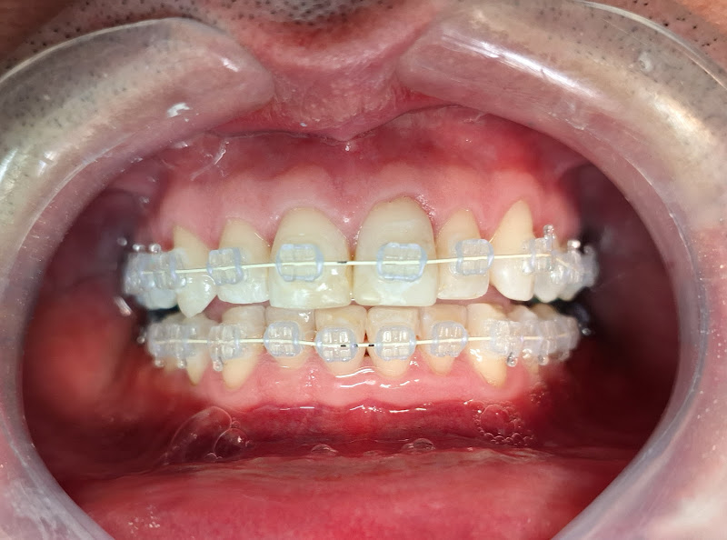 Foto 3 de Simone Reis ortodontia