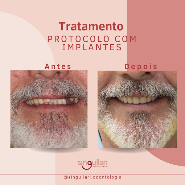 Foto 3 de Singullari