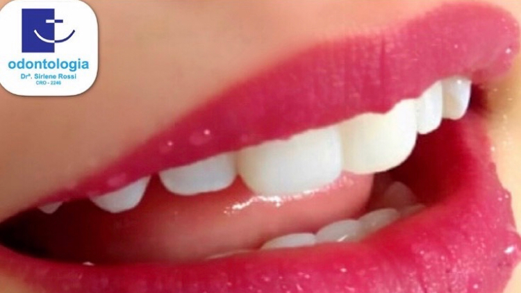 Foto 2 de Sirlene Rossi Odontologia