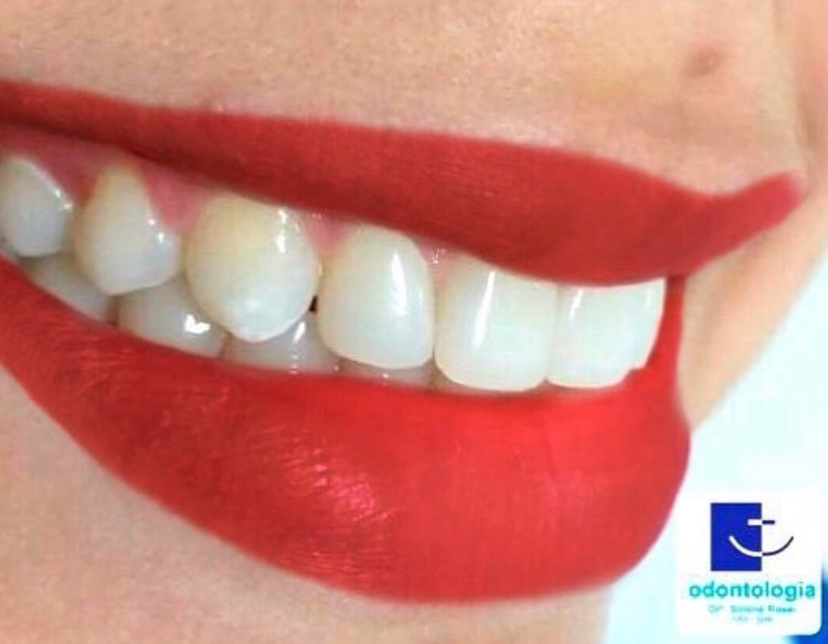 Foto 3 de Sirlene Rossi Odontologia