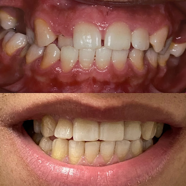 Foto 3 de Sittá Odontologia - Dra. Taciana Ferronato