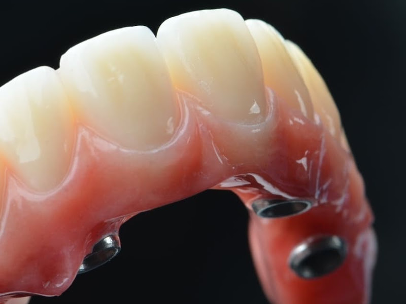 Foto 3 de SLab - Prótese Dentária Premium