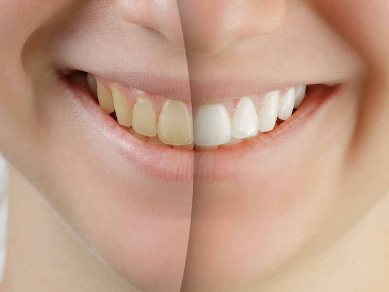 Foto 6 de SM Odontologia | Dentista em Divinópolis - Implante Dentário - Lentes de Contato - Aparelhos Invisíveis