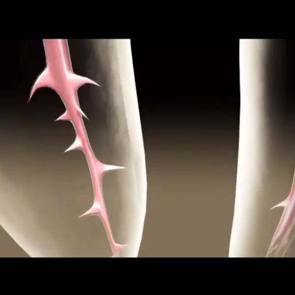 Foto 3 de Smart dente