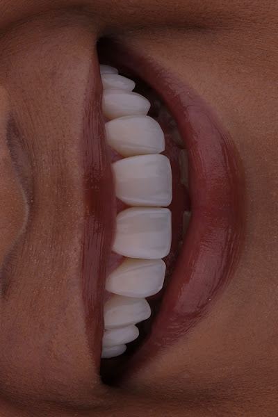 Foto 2 de Smartodonto