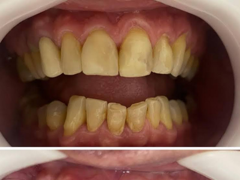 Foto 9 de Smartodonto