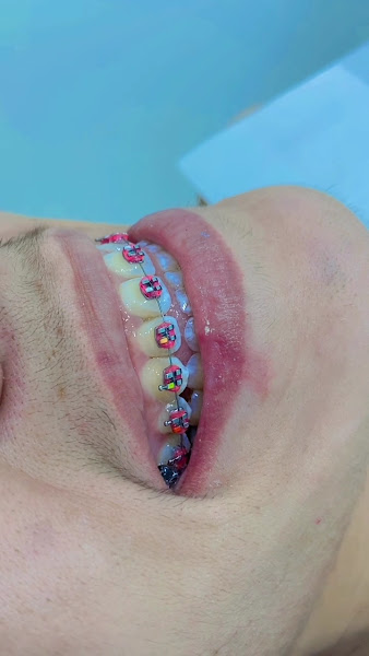 Foto 3 de Smile Odontologia