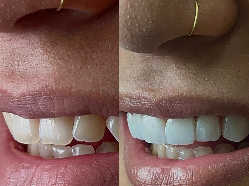 Foto 7 de Smile Odontologia