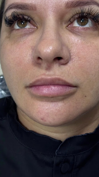 Foto 4 de SmileCare Centro Odontológico Dra. Michele