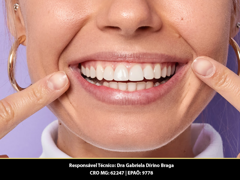 Foto 3 de Só Riso - Dentistas em Patos de Minas | Implantes Dentários