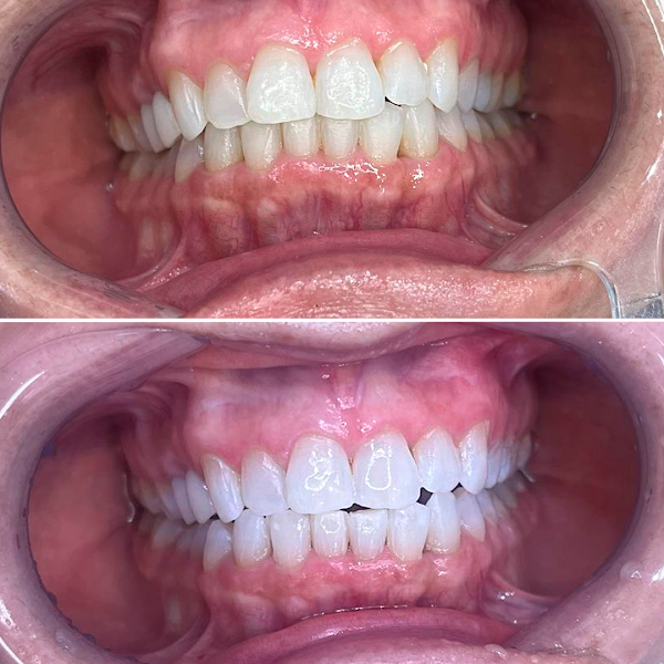 Foto 2 de Só Sorriso Freguesia