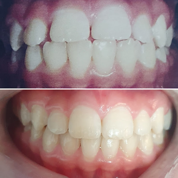 Foto 2 de Só Sorrisos Dentistas