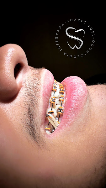 Foto 2 de Soares Soel - Odontologia Integrada