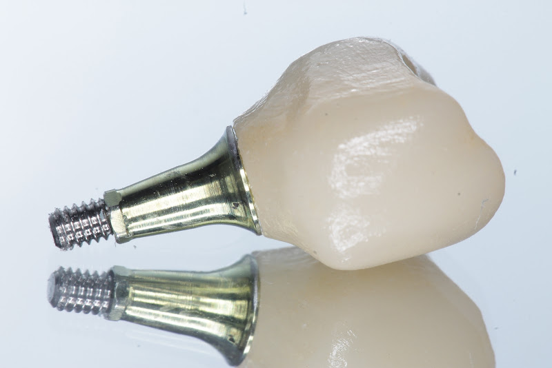 Foto 4 de Solena Odontologia