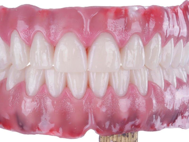 Foto 3 de Soorto - Tratamento Ortodôntico