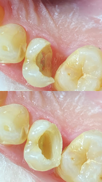 Foto 2 de Soraia Magi Saifeddine- Endodontia (canal)