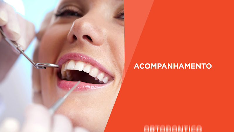 Foto 3 de Sorri Mania - Clínica Odontológica - Samambaia