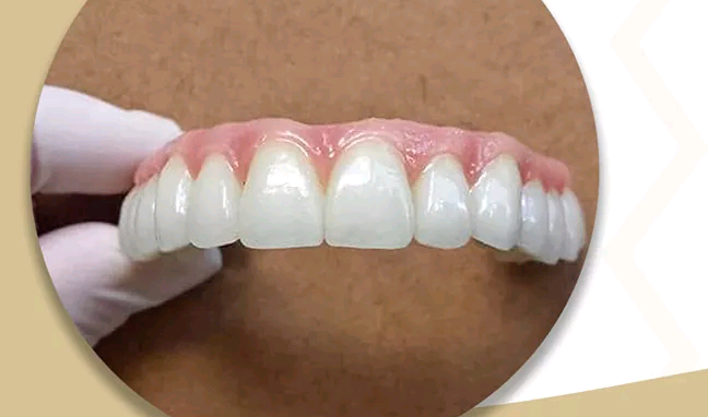 Foto 2 de Sorria De Novo