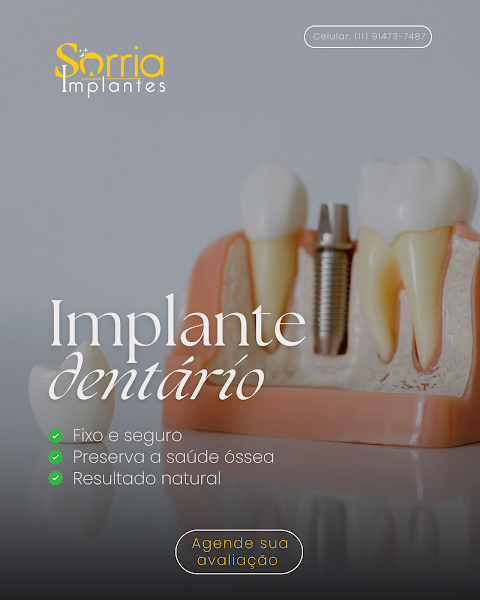 Foto 3 de Sorria Implantes