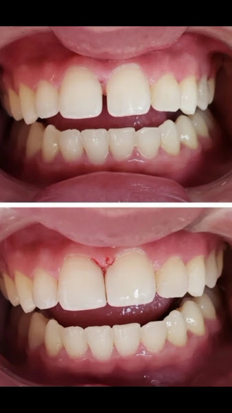 Foto 3 de Sorria Jandaia Dentista