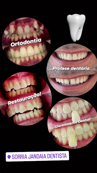 Foto 4 de Sorria Jandaia Dentista