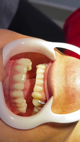 Foto 2 de Sorria Mais Vitória Clínicas Odontológicas