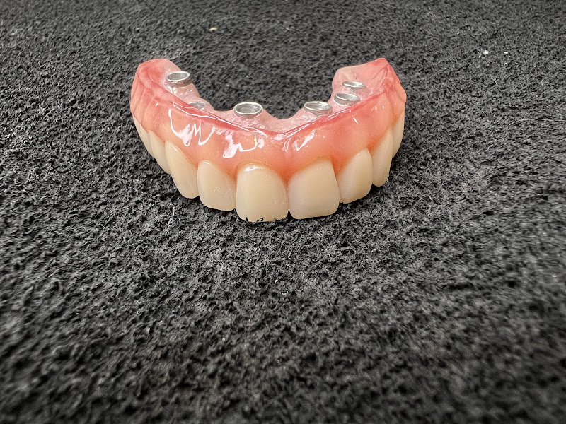 Foto 2 de Sorria Prime - Implante dentário- Madureira