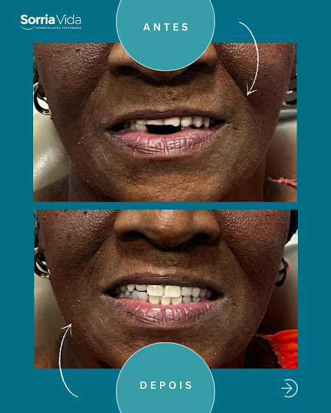 Foto 3 de Sorria Vida Clínica Odontológica