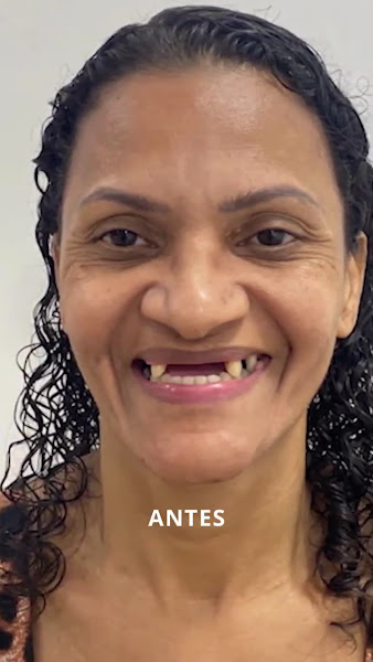 Foto 3 de SorriaMed Clínica Odontológica | Dentistas Especialistas na Taquara, Barra e Méier| Implantes Dentários, Próteses e Estética.