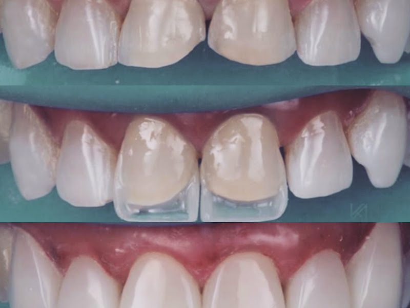 Foto 3 de Sorriasempremais odontologia especializada