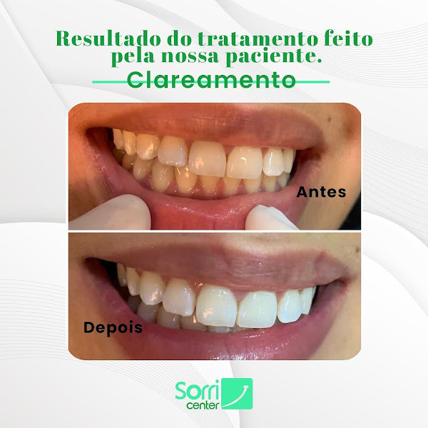 Foto 3 de Sorricenter Damas