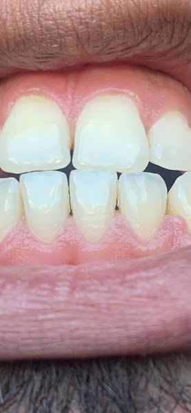 Foto 3 de Sorridente