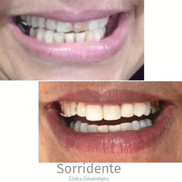 Foto 3 de Sorridente Clínica Odontológica