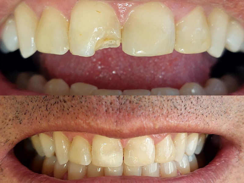 Foto 2 de Sorridente