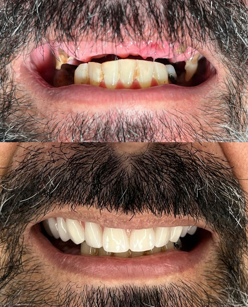 Foto 2 de Sorridents