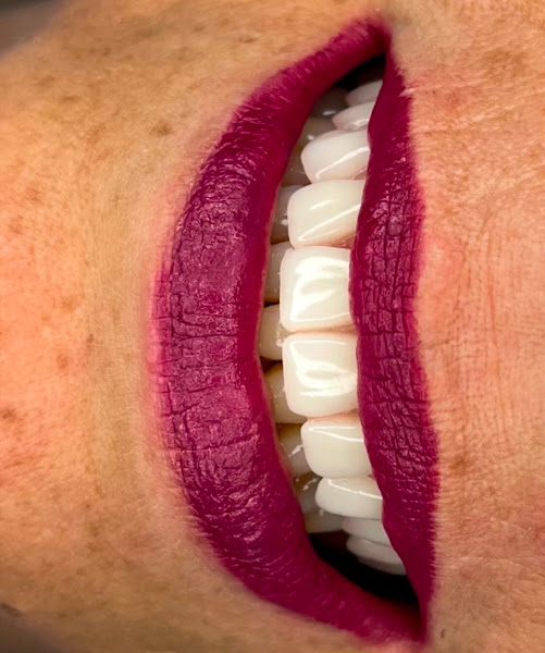 Foto 3 de Sorridents