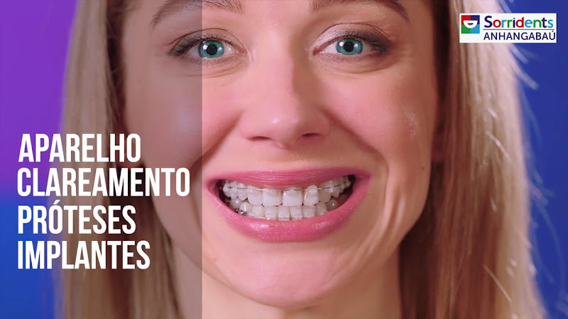Foto 3 de Sorridents Anhangabaú: Clínica Odontológica, Dentista, Implante Dentário, São Paulo SP