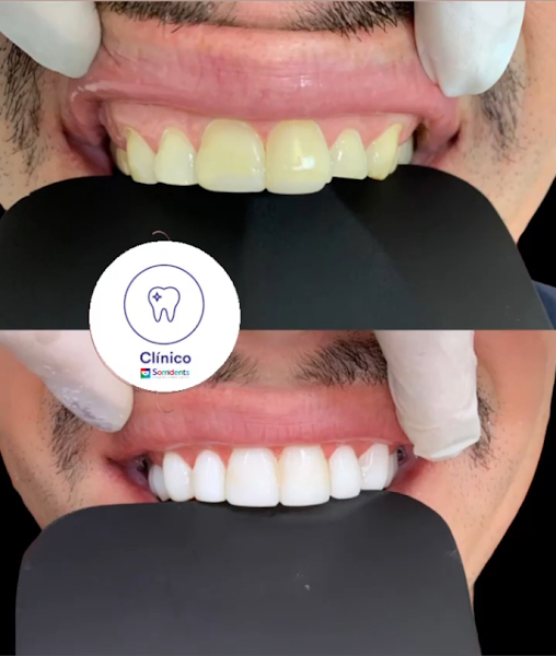 Foto 3 de Sorridents Cidade Tiradentes: Dentista, Clínica Odontológica em São Paulo