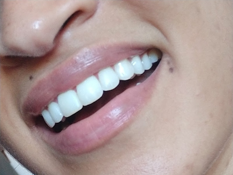 Foto 10 de Sorridents Clínica Odontológica Itaquaquecetuba - Centro