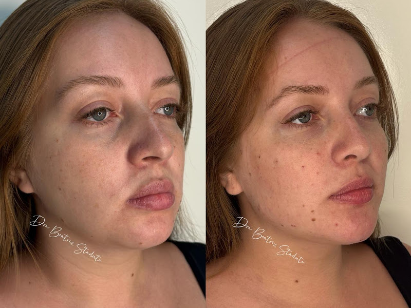 Foto 7 de Sorridents Independência: Dentista, Clínica Odontológica, Clareamento em Taubaté