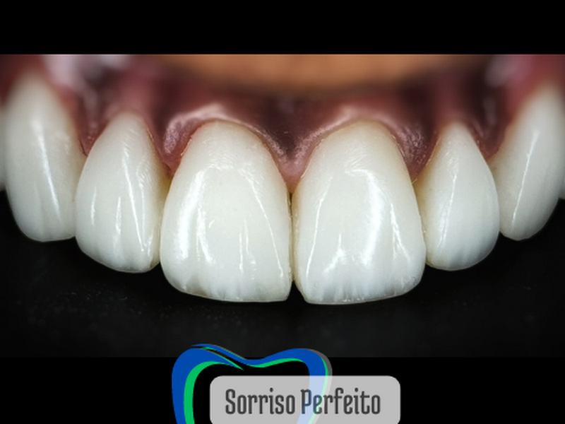 Foto 5 de Sorridents Jardim São João - Guarulhos SP