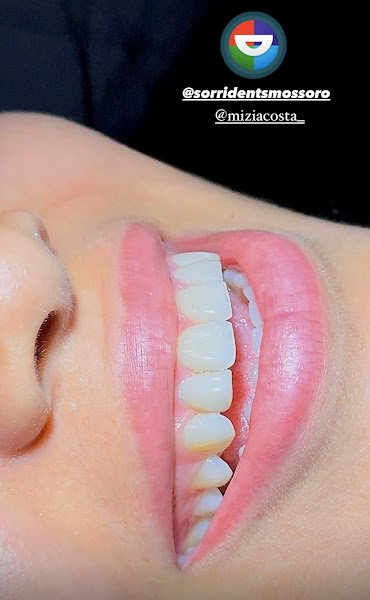 Foto 3 de Sorridents Mossoró: Dentistas, Implantes, Clareamento, Canal, Prótese e Urgência