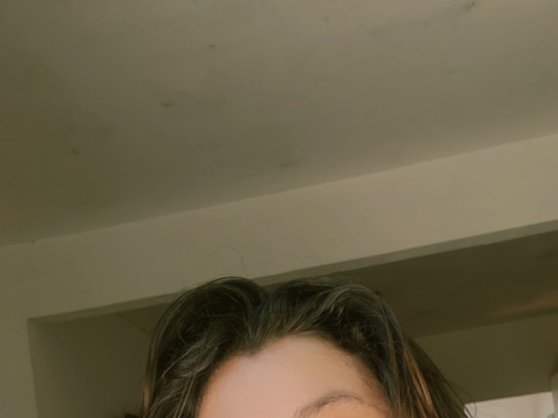 Foto 6 de Sorridents Natal Ponta Negra - Clínica odontológica especializada em ortodontia, estética, implantes e alinhadores,