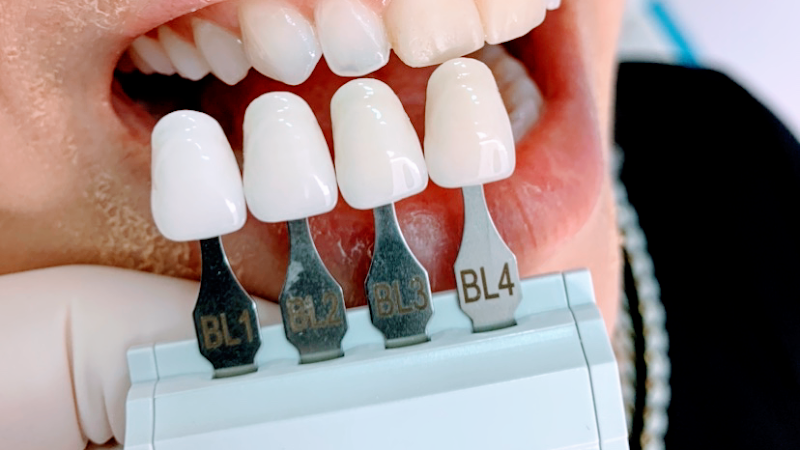 Foto 3 de Sorridents Santo Antônio: Dentista, Clínica Odontológica, Clareamento em Osasco