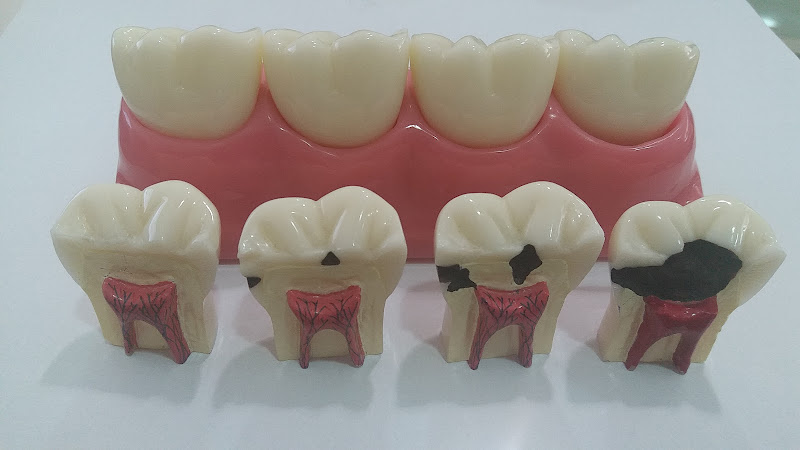 Foto 3 de Sorridents Vila dos Remédios | Implantes | Carga Imediata | Ortodontia | Estética dental | Reabilitação oral |Odontopediatria