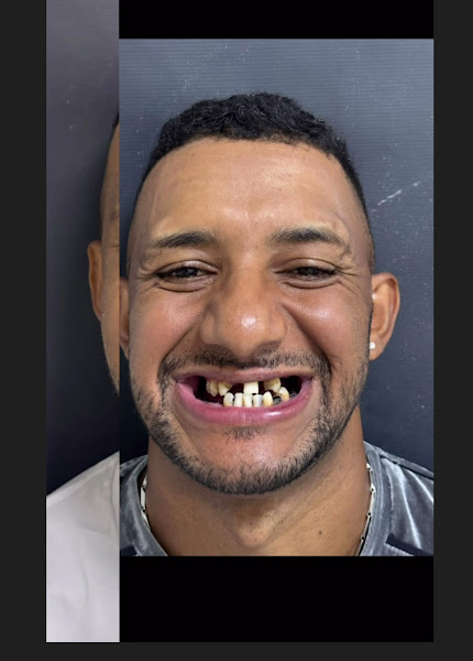 Foto 2 de Sorridents Vila Matilde